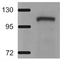ADH/ALDH | Alcohol/acetaldehyde dehydrogenase (bacterial/algal) in the group Antibodies for Plant/Algal  / Environmental Stress / Hypoxia at Agrisera AB (Antibodies for research) (AS10 748)